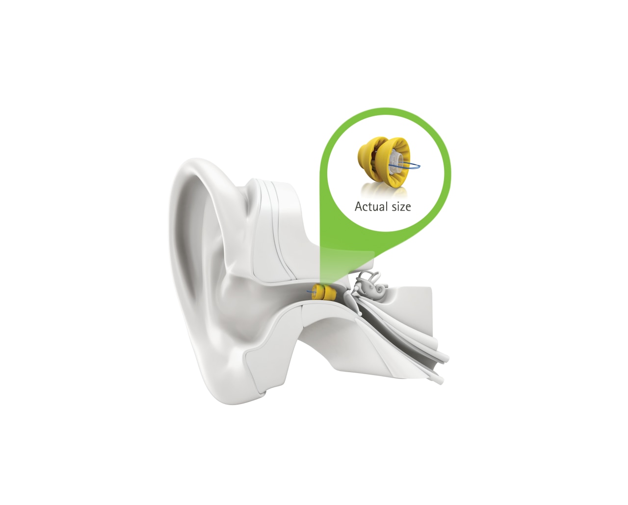 Lyric actual size Phonak hearing aid