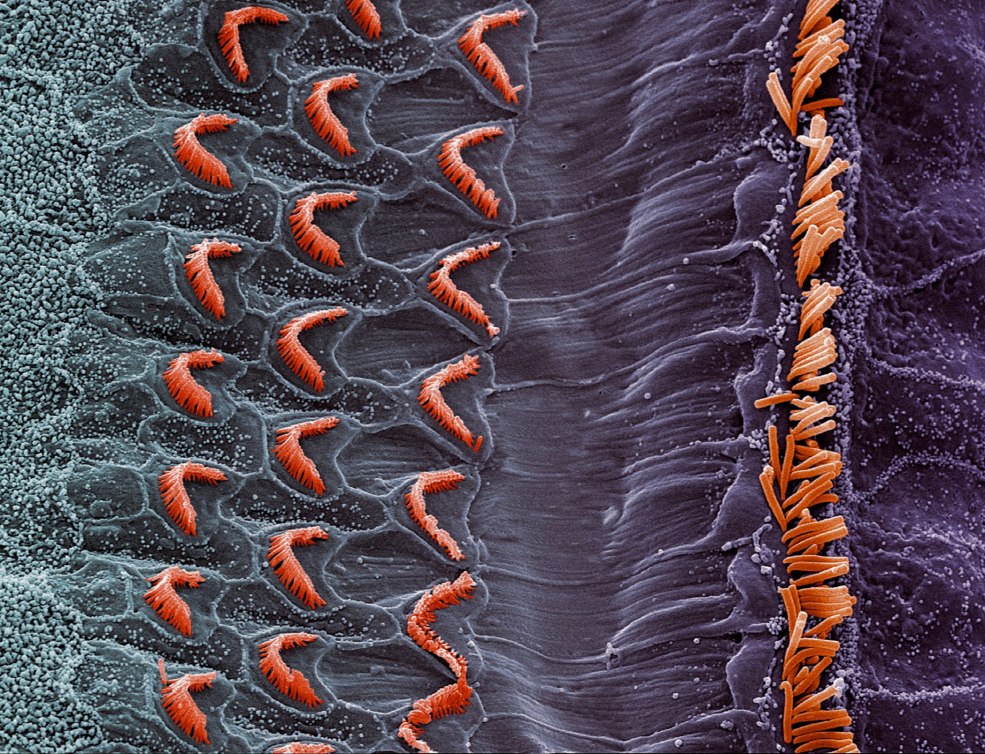 Hvorfor din krop ikke kan reparere skaden